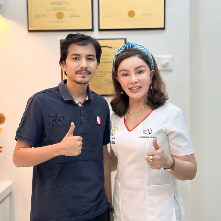 FUE Malaysia - Happy Patient - Natural Real Life Result