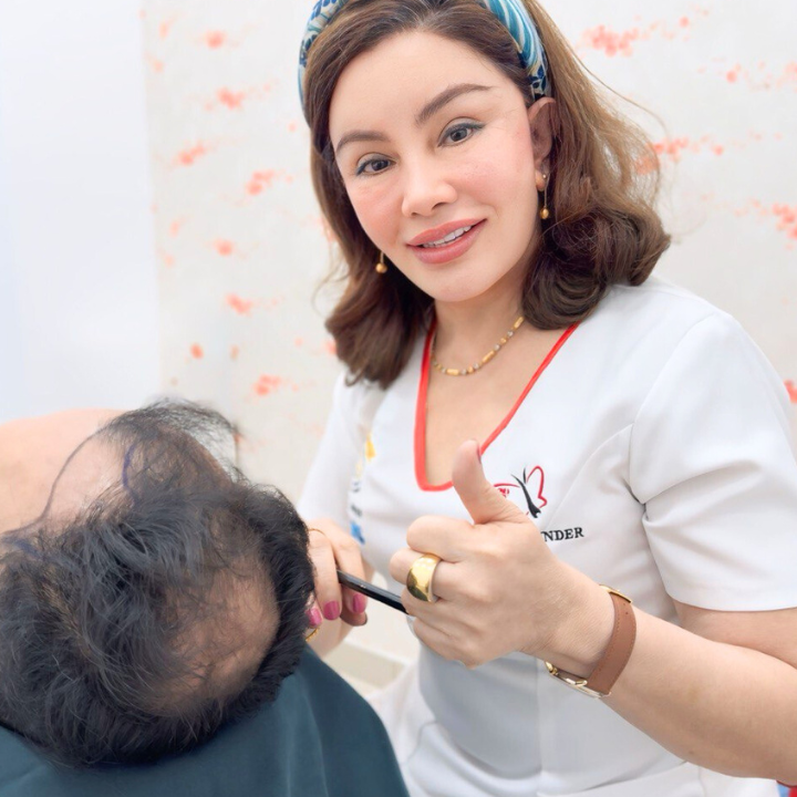 M-Shape Hair Transplant (6)